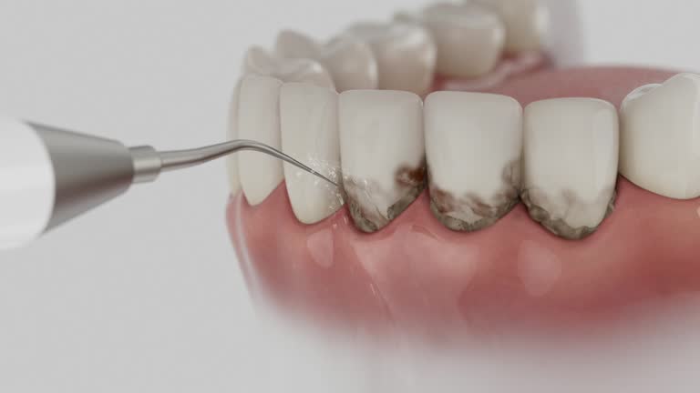 Reliable Dental Crowns And Bridges contractor in Potter County County, SD by Dentist Open Now